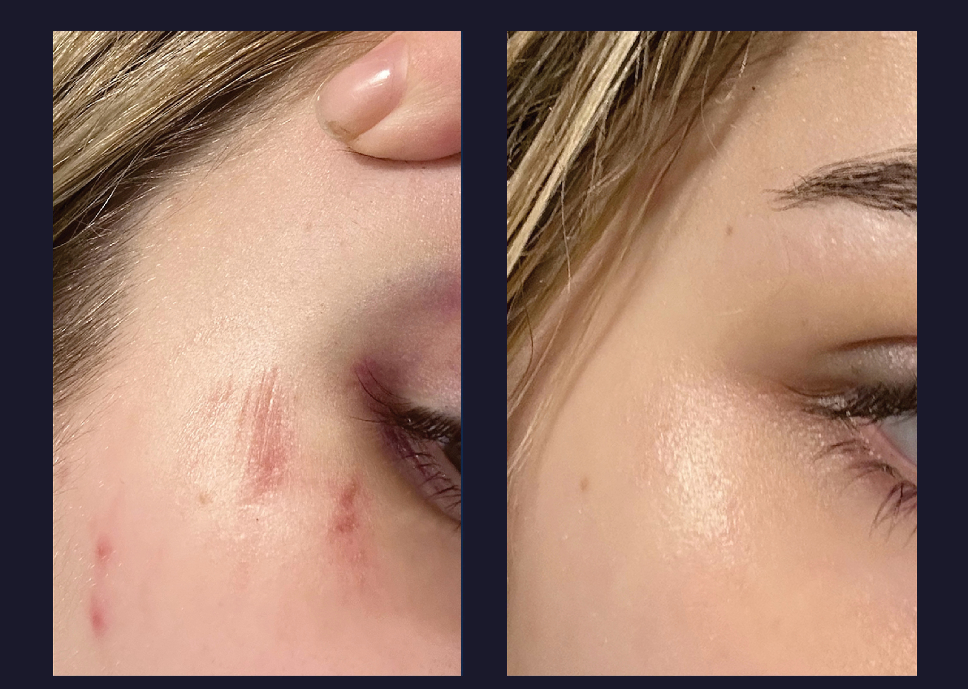 Before and after — skin clarity